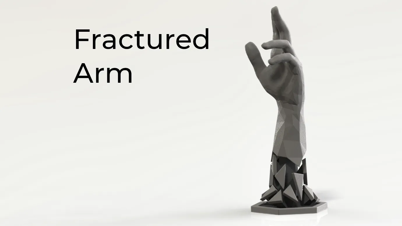 Fractured Arm
