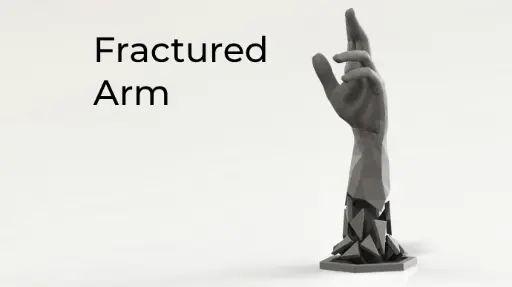 [Fractured Arm] تصميم فني معاصر